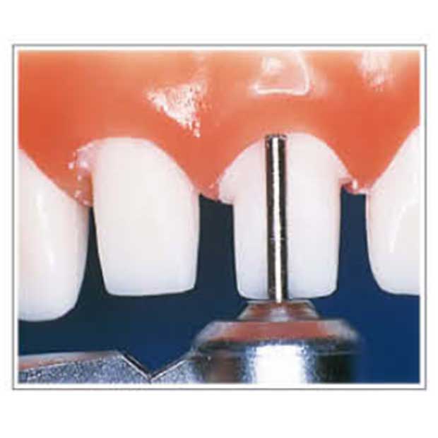 فرز الماسی توربین (END CUT) - 3