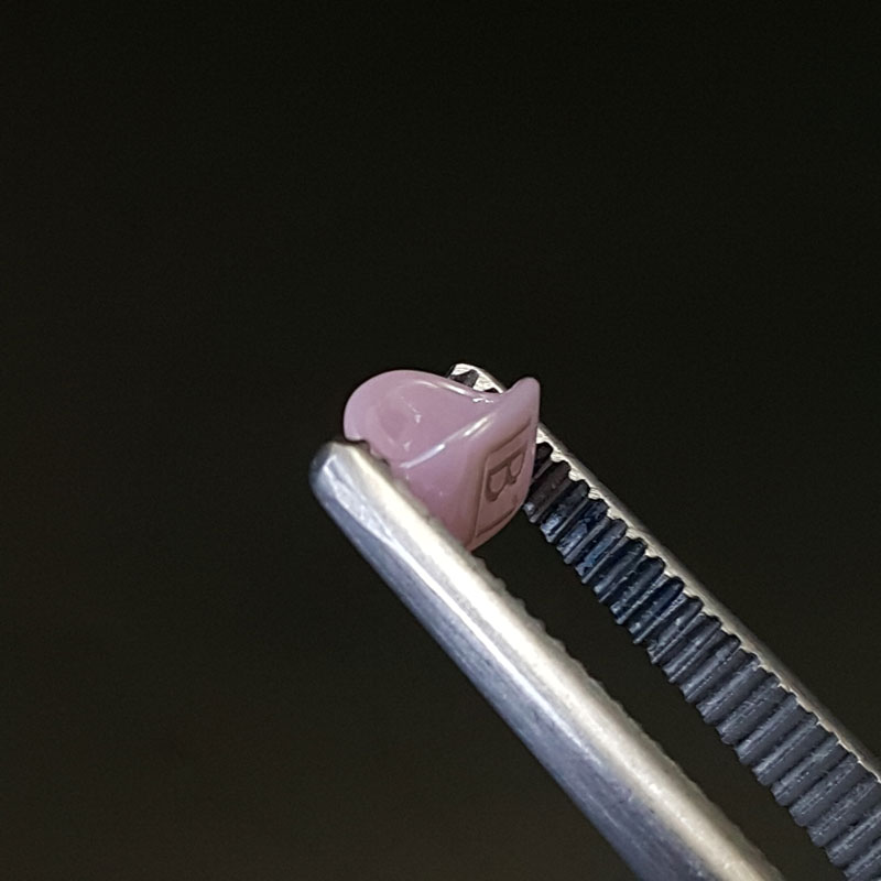 روکش Try-in زیرکونیا شین هانگ کره جنوبی - 2