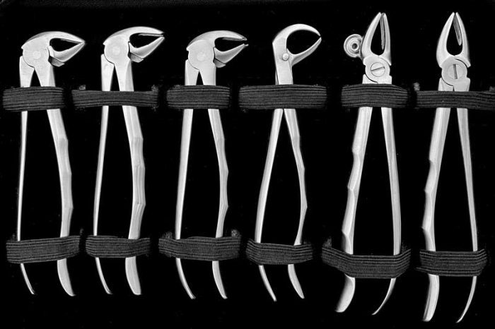 ست فورسپس بزرگسال آناتومیک -کاریزما - 3