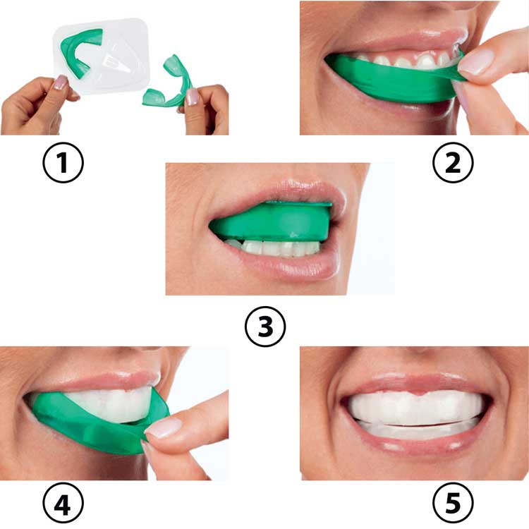 هوم بلیچینگ اپالسنس 15%- GO - 2