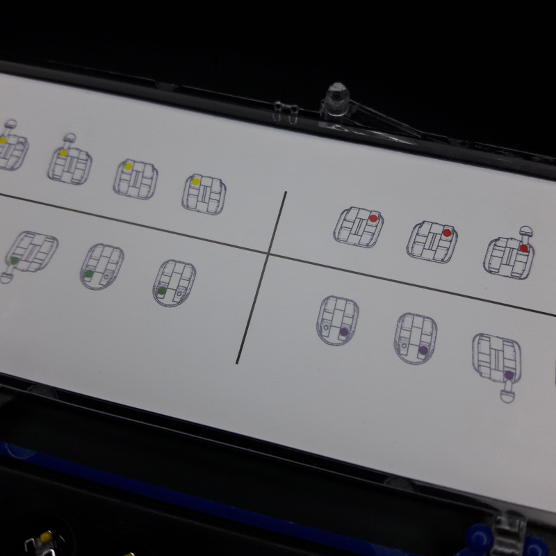کیت براکت ارتودنسی MBT سینو ارتو - 5