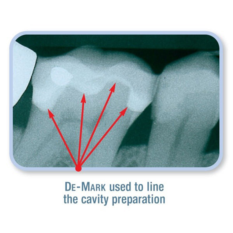 کامپوزیت فلو دی مارک کازمدنت - 2