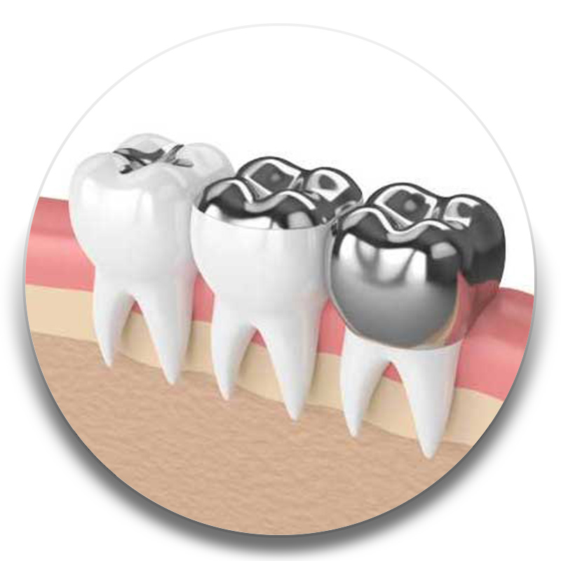 روکش و بند شیری