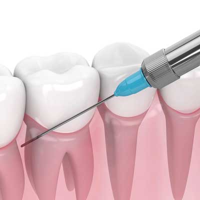 سرسوزن - سرنگ